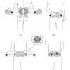 schéma de mise en place de la ceinture lombogib easy gibaud