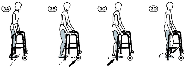 Comment se servir d'un déambulateur ?